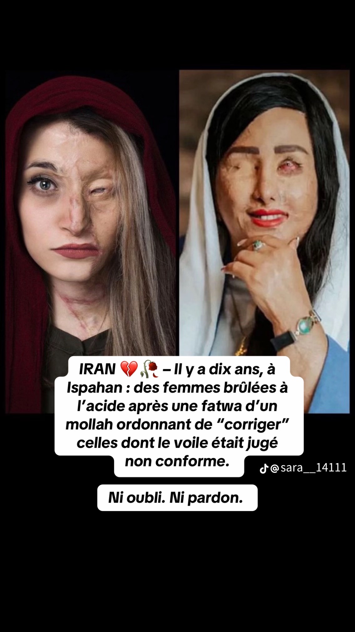 Montage Sara, TikTok : à gauche son visage en deuil, à droite une survivante d’Ispahan en habit clair et bijoux, et le texte « IRAN — Il y a dix ans, à Ispahan : des femmes brûlées à l’acide après une fatwa d’un mollah ordonnant de corriger celles dont le voile était jugé non conforme. Ni oubli. Ni pardon. »
